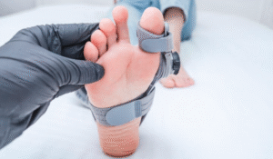 Diagnosis Beyond the Visible Bump