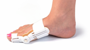 The orthopedic philosophy for treating Hallux Valgus